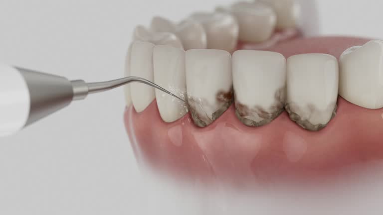 Reliable Dental contractor in Sterling, IL by Smile Center Dentistry